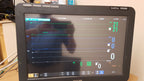 Philips IntelliVue MX800 Monitor 865240 W/ FMS