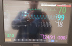 Philips IntelliVue MX800 Monitor 865240