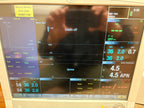 GE E-sCAiOV sCAiOV Gas Module (with spirometry)