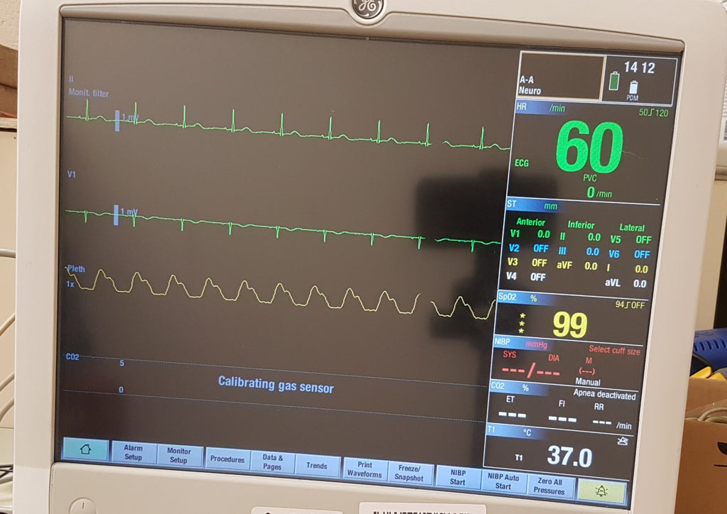 GE Healthcare CARESCAPE B650 - 6ICU, 6NIC Monitor