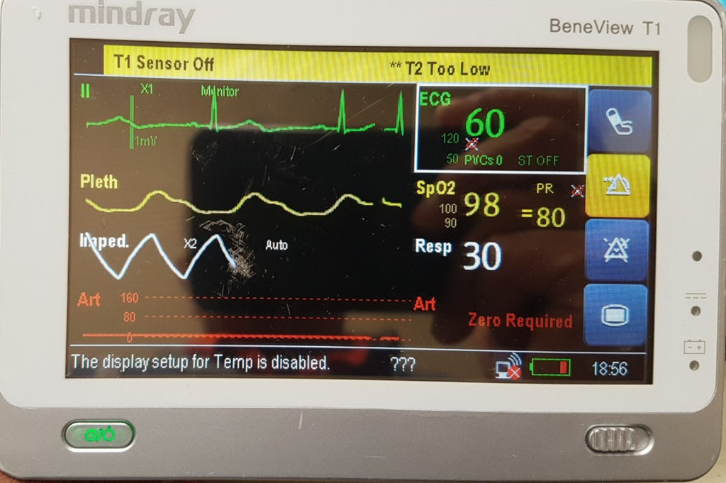 Mindray BeneView T1 Monitor