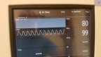 Phillips IntelliVue MP5 Patient Monitor with Microstream CO2 w/ Battery