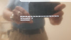 Philips IntelliVue MX800 Monitor 865240 W/ FMS