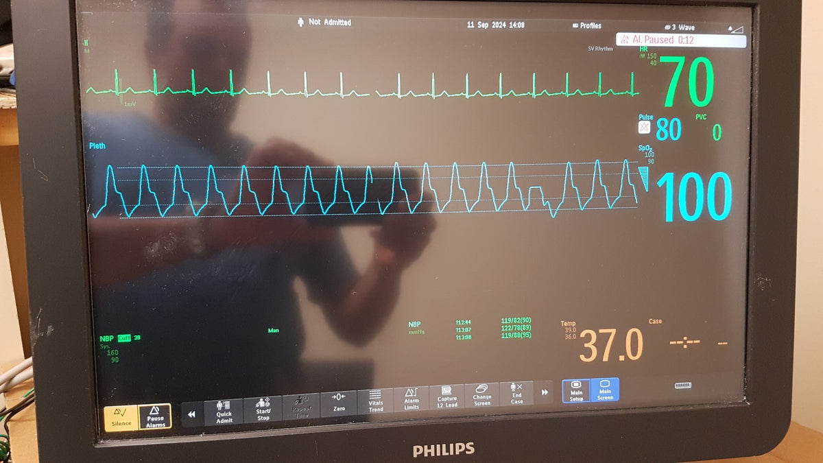 Philips IntelliVue MX800 Monitor 865240 W/ FMS