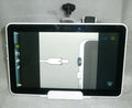 Ambu aView 2 Advance Monitor W/ Power Supply & Mount (No Tariffs to USA)