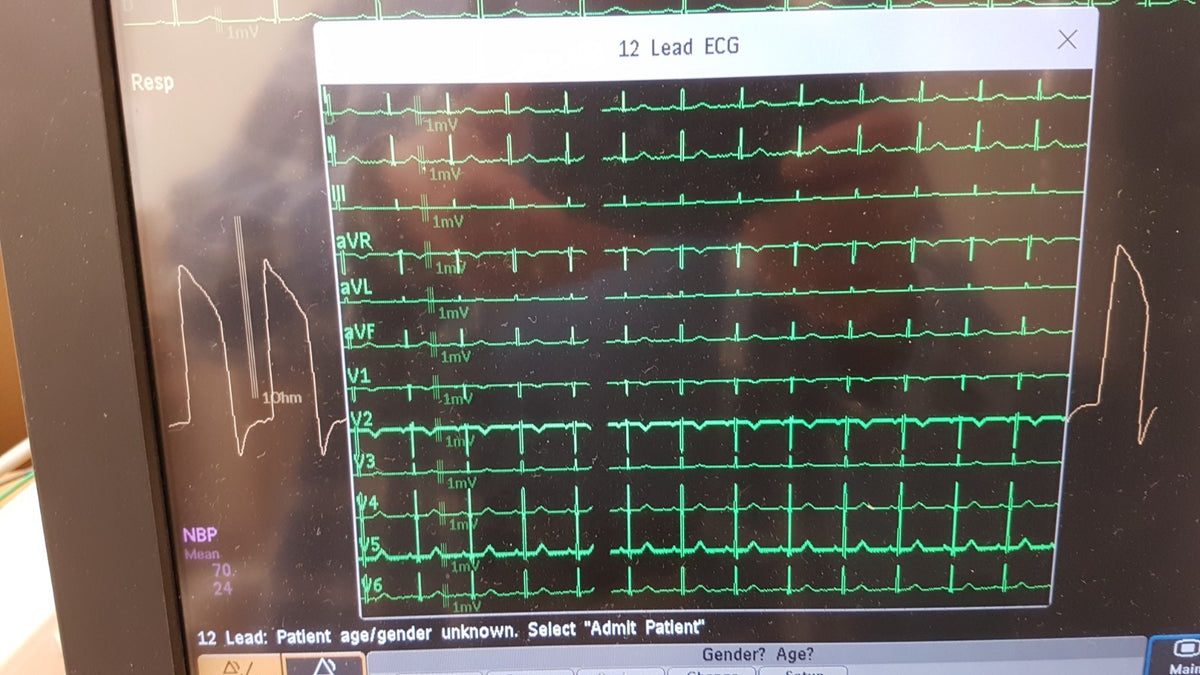 Philips IntelliVue MMX Module 867036 12 Lead ECG Biomed Tested