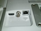 Ambu aView 2 Advance Monitor w/ Power Supply (No Tariffs to USA)