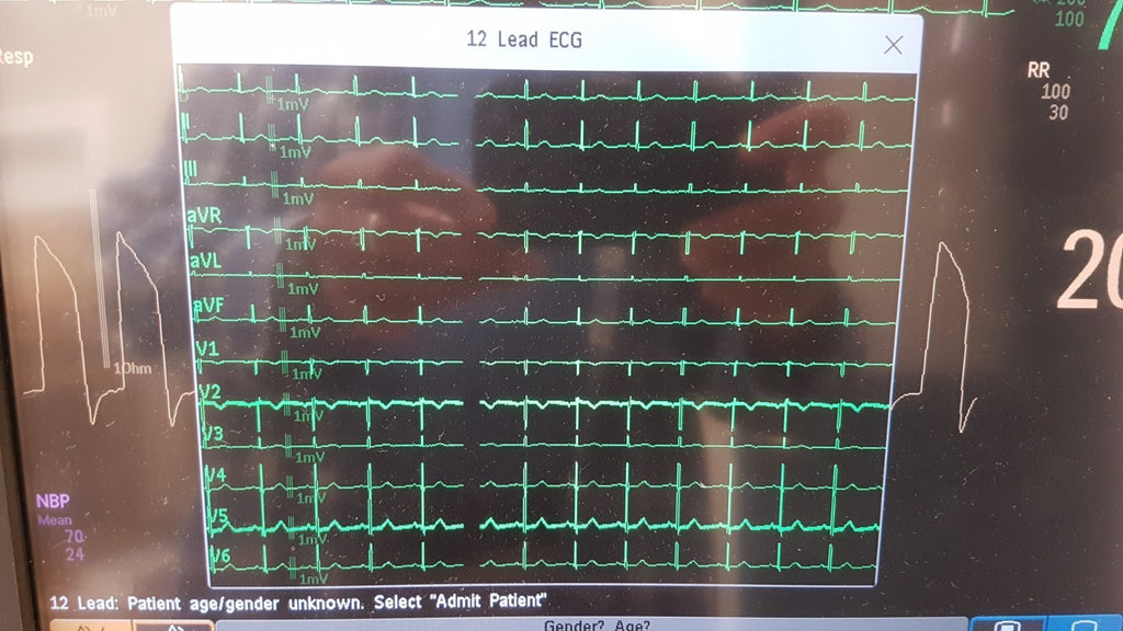 Philips IntelliVue MMX Module 867036 12 Lead ECG Biomed Tested