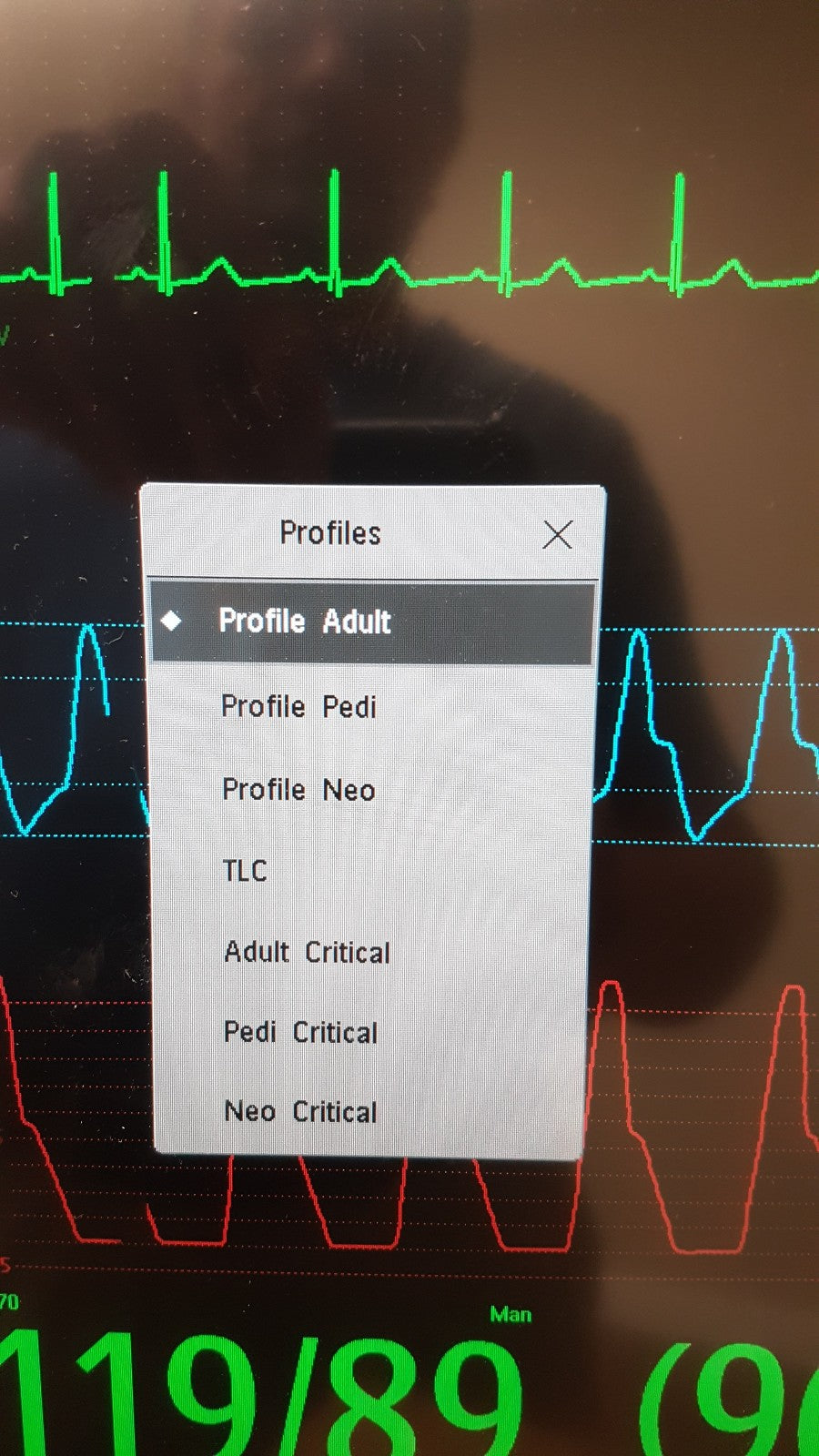 Philips IntelliVue MX800 Monitor 865240 W/ FMS