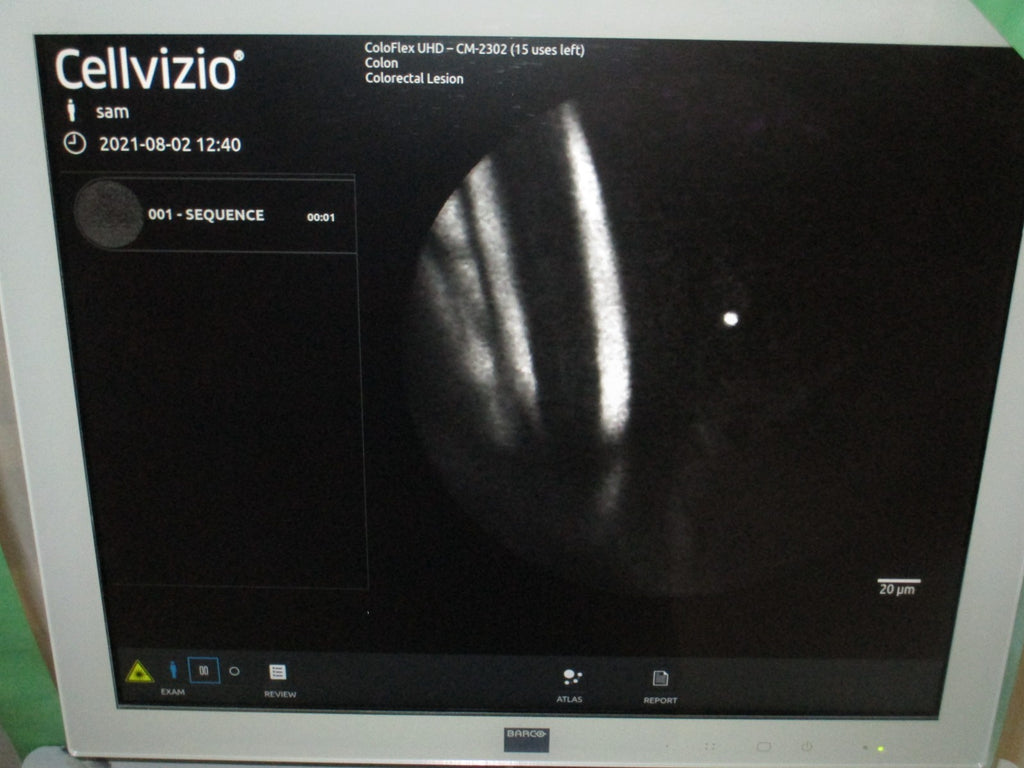 Cellvizio ColoFlex UHD Miniprobe tested