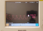 Philips M3015A CO2 Module
