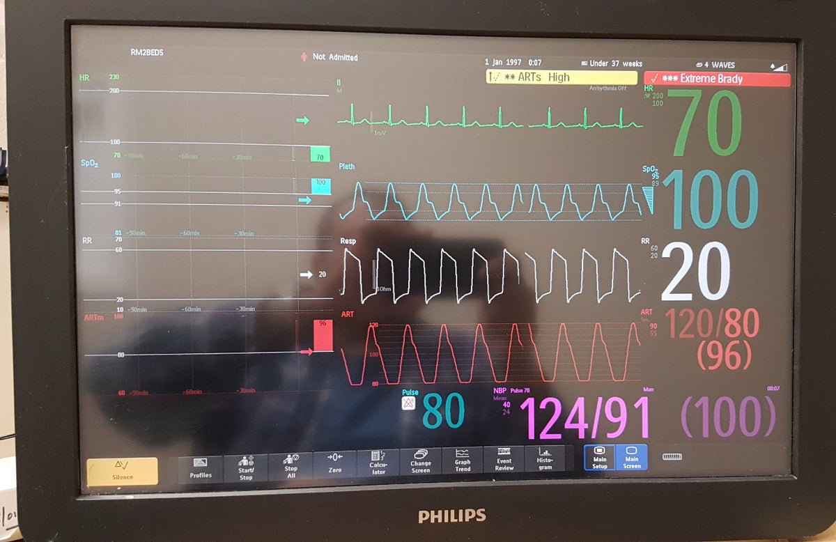 Philips IntelliVue MX800 Monitor 865240