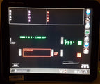 Spacelabs Xprezzon 94267 Display Monitor (No Power Supply Included)