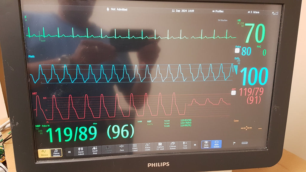 Philips IntelliVue MX800 Monitor 865240 W/ FMS