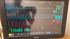 Philips IntelliVue MX800 Monitor 865240 W/ FMS