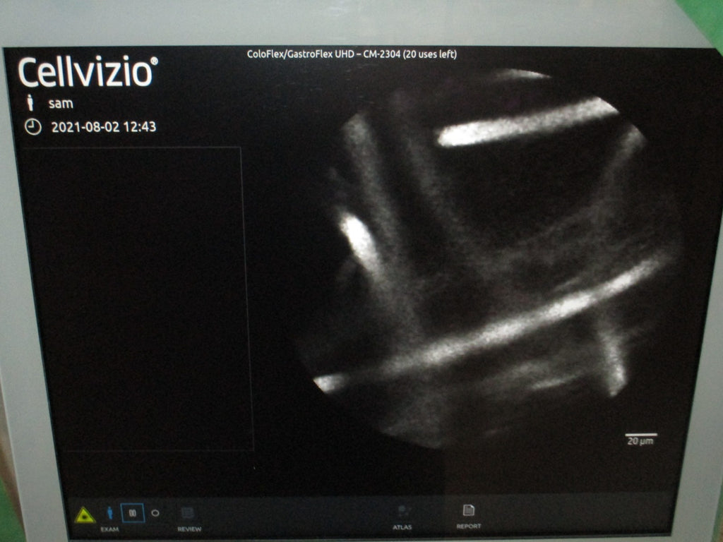 Cellvizio ColoFlex UHD Miniprobe tested