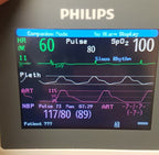 Philips IntelliVue Intelli Vue X2 Vital Sign Patient Monitor M3002A Rev H