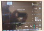 GE E-CAIOV-00 Anesthesia w/ Spirometry Gas Module