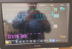 Philips IntelliVue MX800 Monitor 865240