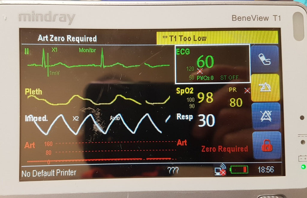 Mindray BeneView T1 Monitor