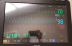 Philips IntelliVue MX800 Monitor 865240 W/ FMS