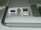 Ambu aView 2 Advance Monitor w/ Power Supply (No Tariffs to USA)