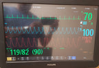 Philips IntelliVue MX800 Monitor 865240 W/ FMS