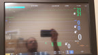 Philips IntelliVue MX800 Monitor 865240 W/ FMS