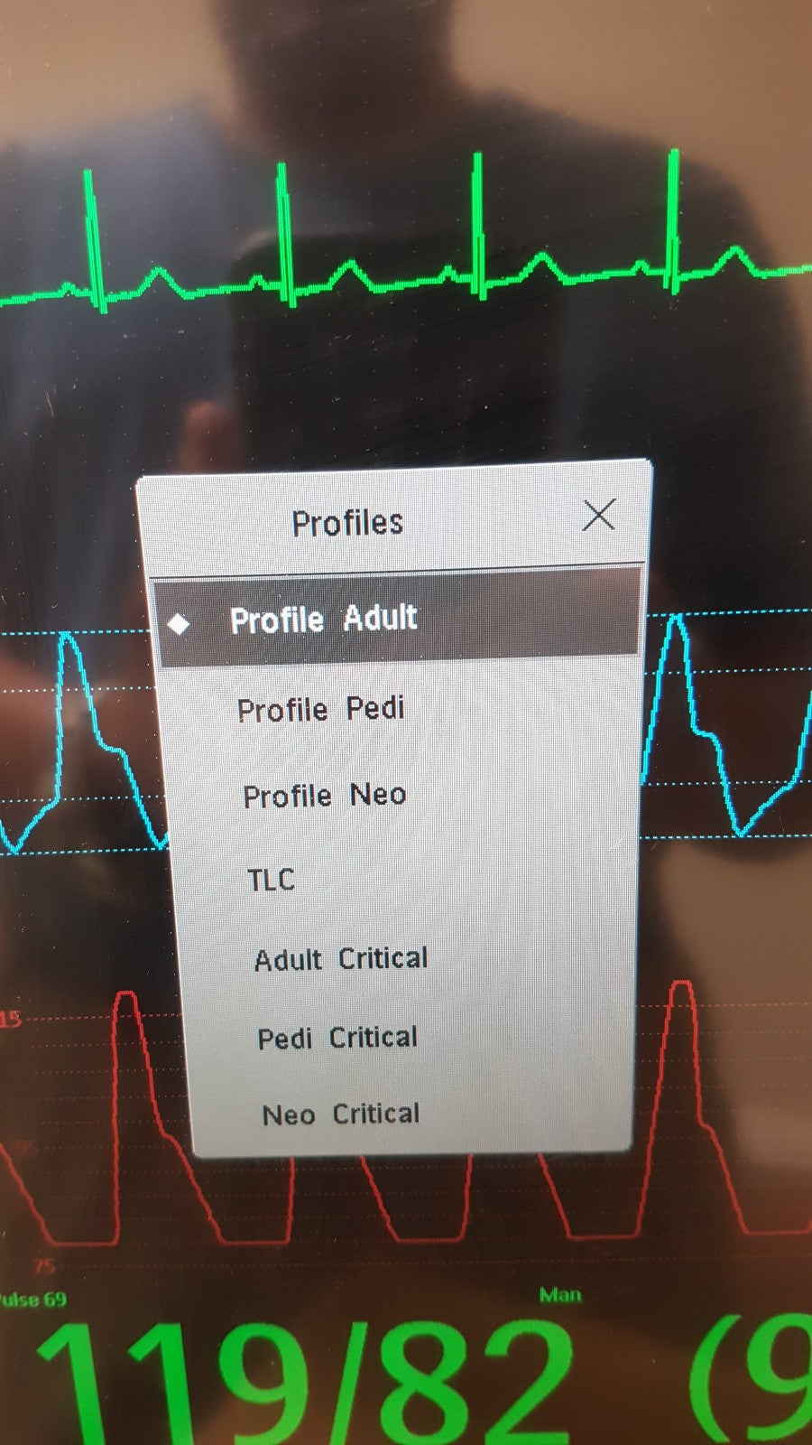 Philips IntelliVue MX800 Monitor 865240 W/ FMS