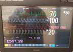 Philips IntelliVue MX800 Monitor 865240