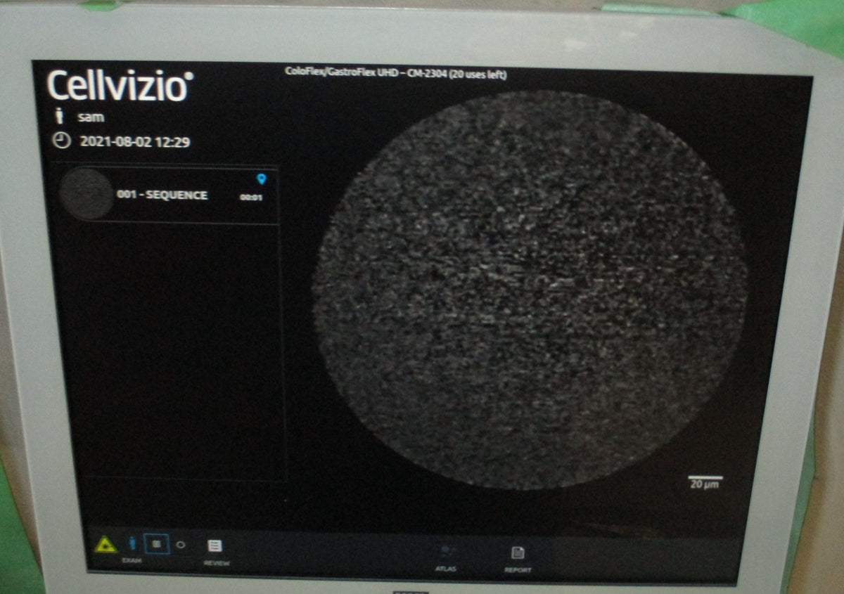 Cellvizio ColoFlex UHD Miniprobe tested